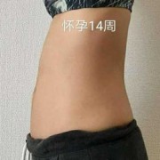 胎儿肚子大（胎儿肚子大怎么回事）