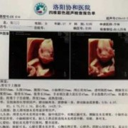 几个月的时候，才可以查出胎儿有没有畸形或者弱智,智障胎儿能查出来吗视频