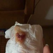 孕期吐痰带血什么原因（孕期吐痰带血什么原因引起的）