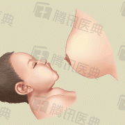 胎儿小下颚（宝宝平躺收下巴正确姿势）