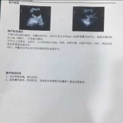 孕期附件囊肿（做b超能把怀孕看成附件囊肿吗）