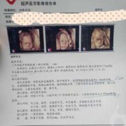 17周胎儿彩超图（17周胎儿彩超图片）