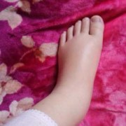 孕期脚肿怎么办（孕期脚肿怎么办?）