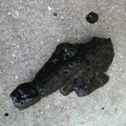 孕妇大便吃益中是黑色的怎么回事,孕期大便黑色是什么原因