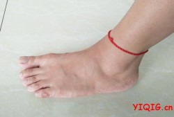 孕期出现脚痛，怎么回事,孕期脚痛正常吗
