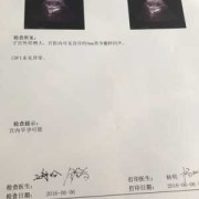 请问CDFI:探及胎心血流信号是什么意思,cdfi是胎儿的什么意思