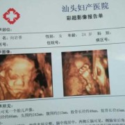 胎儿下巴小（胎儿下巴小会出现什么后果）