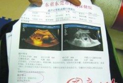 胎儿b超报告（胎儿b超报告单怎么看）