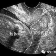 宫颈口长度的正常范围是多少,孕期正常宫颈长度是多少mm