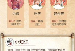 孕期外痔怎么治疗方法（孕期外痔怎么治疗方法图片）