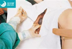 胎儿几斤不用侧切（胎儿几斤不用侧切）