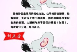 怎样有利于胎儿转头位（怎样有利于胎儿转头位呢）