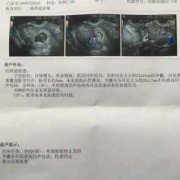 血流信号是胎儿的什么（血流信号是胎儿的什么部位）
