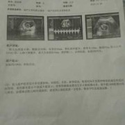 孕十一周胎儿发育情况（孕11周胎心率177正常吗）