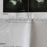 孕囊就是胎儿吗（孕囊就是胎儿吗?）