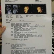 胎儿头圆还是椭圆好（胎儿头圆还是椭圆好看）