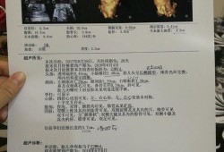 胎儿头圆还是椭圆好（胎儿头圆还是椭圆好看）
