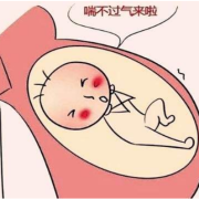 胎儿缺氧孕妇表现是什么,怎样才能知道胎儿缺氧不缺氧