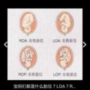 胎儿左枕前位是什么意思（胎儿左枕前位是什么意思图片）