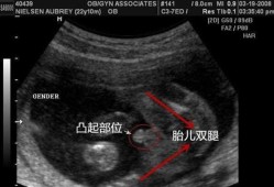 孕8周胎儿图辨别男女（孕8周胎儿图辨别男女）