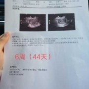 阴超会对宝宝有影响吗,怀孕了做阴超对胎儿有影响吗