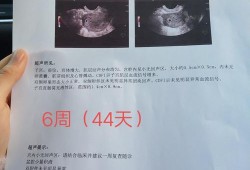 阴超会对宝宝有影响吗,怀孕了做阴超对胎儿有影响吗