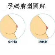 孕期乳房图片（孕妇乳房不一样大怎么回事）