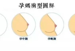 孕期乳房图片（孕妇乳房不一样大怎么回事）