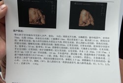 胎儿七个月四维彩超可以检查什么,7周胎儿彩超图片