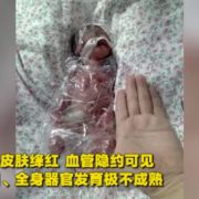 胎儿一个月（宝宝出生后一个月体重只增加了一斤，正常吗）