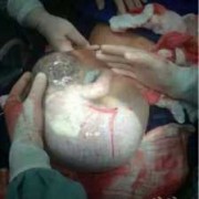 34周胎儿在肚子里是什么样子的呢,34周的胎儿图片欣赏