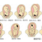 胎儿app（胎儿apple）