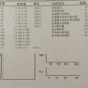 孕妇尿检细菌值很高应该怎么治疗,孕期尿检细菌高是什么原因