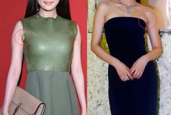 副乳严重是内衣大了还是小了,孕期副乳乳头会消失吗
