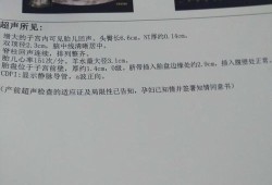 nt图片胎儿（NT结果怎么看）
