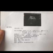 fl是什么中文缩写,fl是胎儿的什么指标