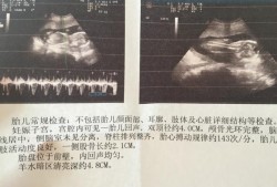 胎儿心跳140是男是女（胎儿心跳140是男孩女孩）