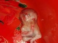 胚胎停育有什么症状,孕早期胎儿停育有什么症状