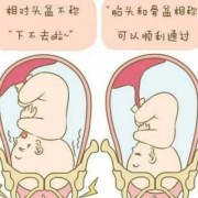 胎儿没入盆可以顺产吗（胎儿没入盆可以顺产吗?）