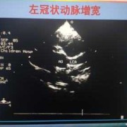 胎儿冠状动脉瘘可自愈（2022先心病报销政策）