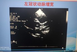 胎儿冠状动脉瘘可自愈（2022先心病报销政策）