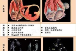 胎儿左心室强光点原因（胎儿左心室强光点原因是什么）