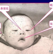 什么叫三体综合症,胎儿综合症有哪些