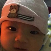 刚出生的婴幼儿的皮肤是都很白吗？为啥我的宝宝皮肤很黑,胎儿黑是什么原因