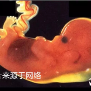 3维是指检查胎儿的哪些方面,