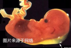 3维是指检查胎儿的哪些方面,
