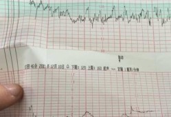 胎儿心电图（怀孕多少周能做心电图，血常规啊）