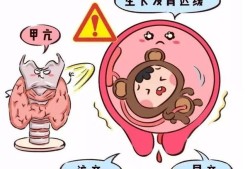 孕晚期甲亢对胎儿影响（孕晚期甲亢对胎儿影响大吗）