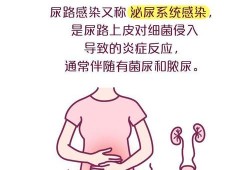 尿路感染对胎儿有影响吗（孕晚期尿路感染会对胎儿有影响吗）