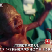 29周胎儿早产（29周胎儿早产存活率）